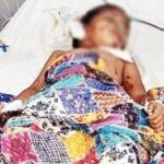 नारेगावात मोकाट कुत्र्यांनी केला ४ वर्षीय चिमुकलीवर हल्ला; शरीरावर 50 हून अधिक गंभीर जखमा