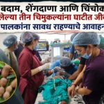 बदाम, शेंगदाणा आणि चिंचोका गिळलेल्या तीन चिमुकल्यांना घाटीत जीवदान; पालकांना सावध राहण्याचे आवाहन