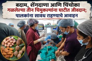 बदाम, शेंगदाणा आणि चिंचोका गिळलेल्या तीन चिमुकल्यांना घाटीत जीवदान; पालकांना सावध राहण्याचे आवाहन
